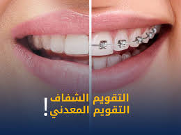 تقويم الأسنان